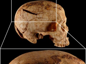 Imagen compuesta de uno de los cráneos estudiados, procedente de la necrópolis de Qubbet el-Hawa