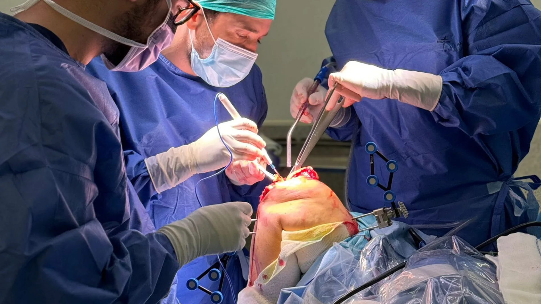 Ningún otro hospital en la provincia de Alicante dispone de esta tecnología