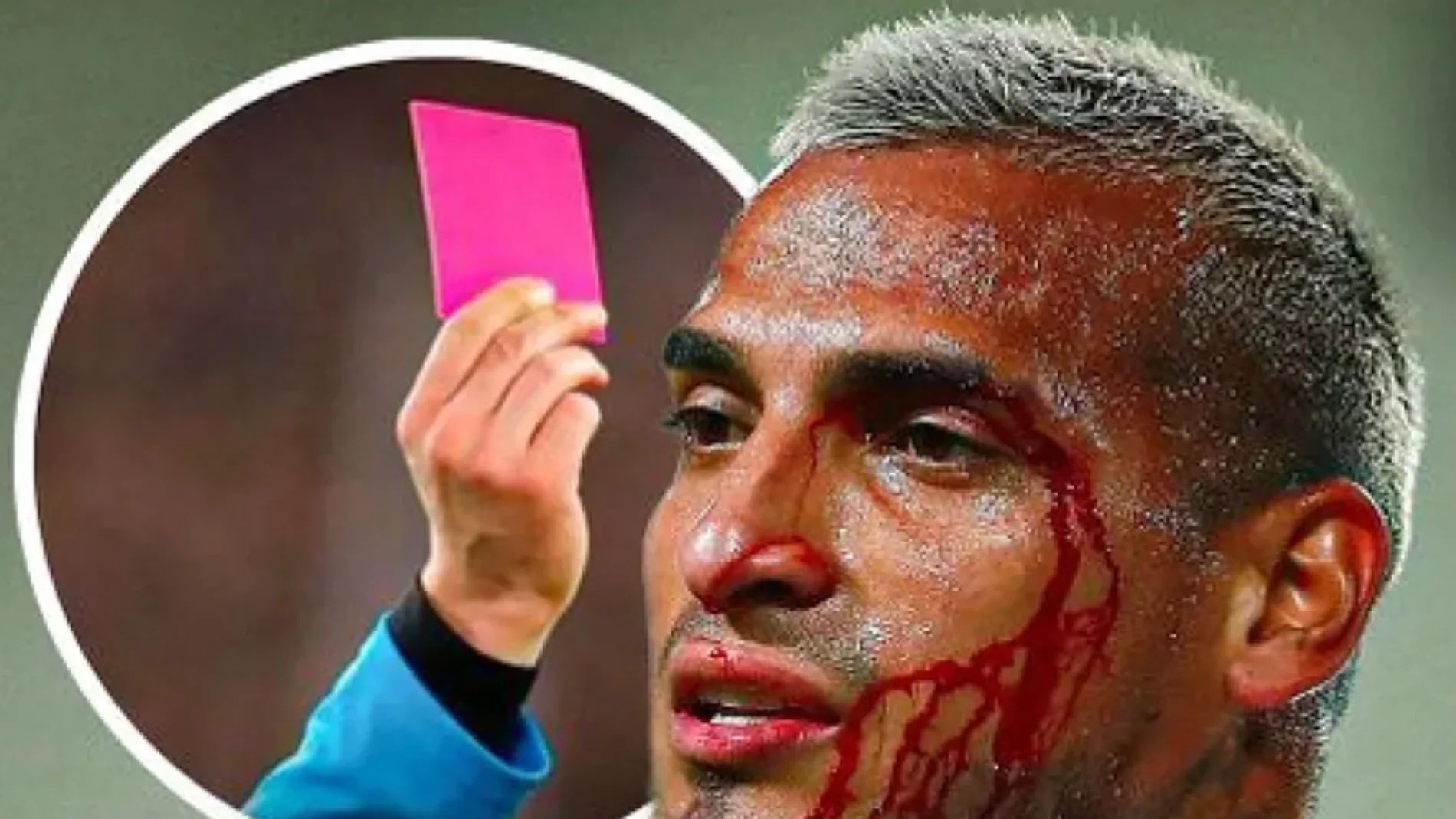 La tarjeta rosa se estrenará en la Copa América: ¿Para qué sirve?