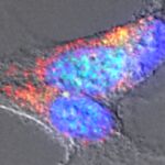 Imagen de microscopía de neuronas tratadas con amiloides bacterianos en las que se detectan agregados de α-sinucleína