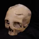 El cráneo E270, que data de entre 663 y 343 a.C., pertenecía a una mujer mayor de 50 años