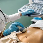 Un sanitario hace una ecografía abdominal a una paciente
