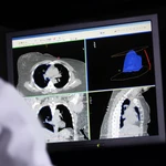 Un médico analiza los pulmones de un paciente