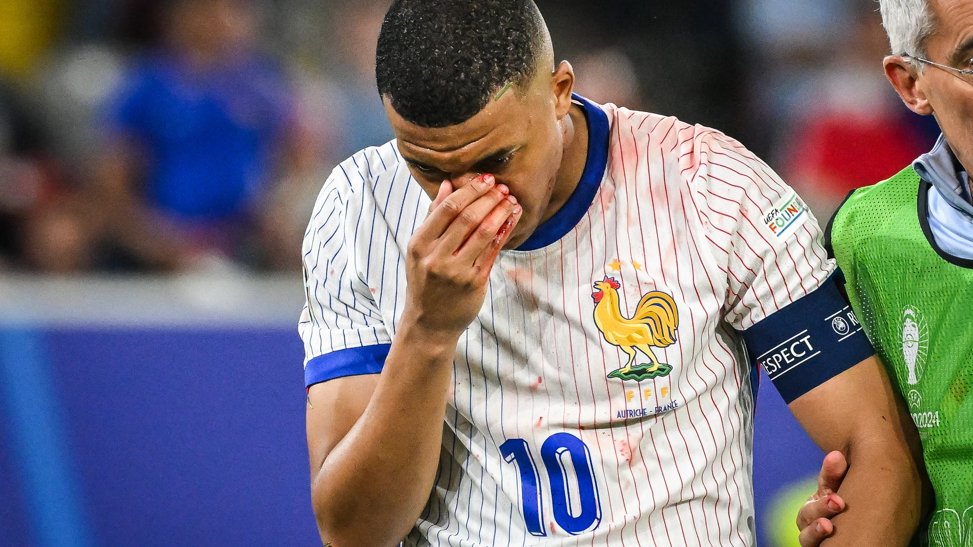 Kylian MBAPPE of France looks injured during the UEFA Euro 2024, Group D, football match between Austria and France on June 17, 2024 at Merkur Spiel-Arena in Dusseldorf, Germany - Photo Matthieu Mirville / DPPI AFP7 17/06/2024 ONLY FOR USE IN SPAIN