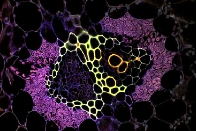 Sistema vascular de la piña bajo el microscopio