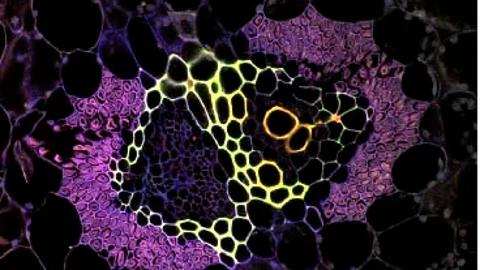 Sistema vascular de la piña bajo el microscopio