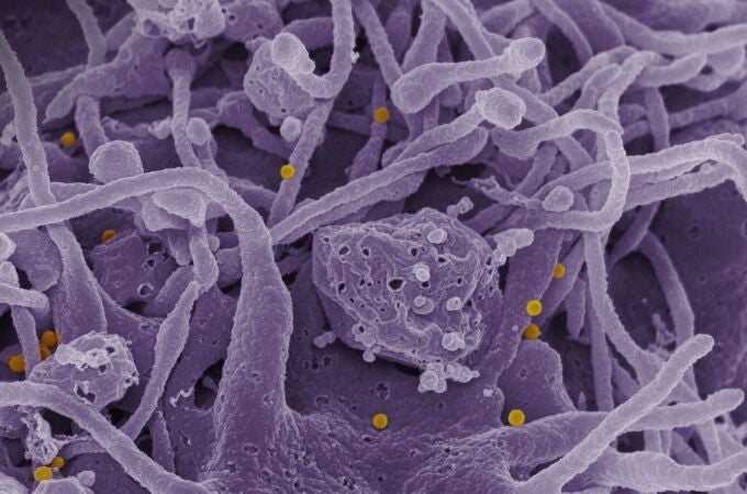Virus Congo