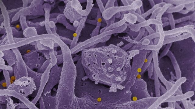 Virus Congo