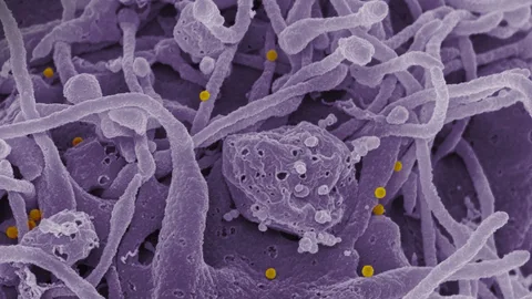 Virus Congo