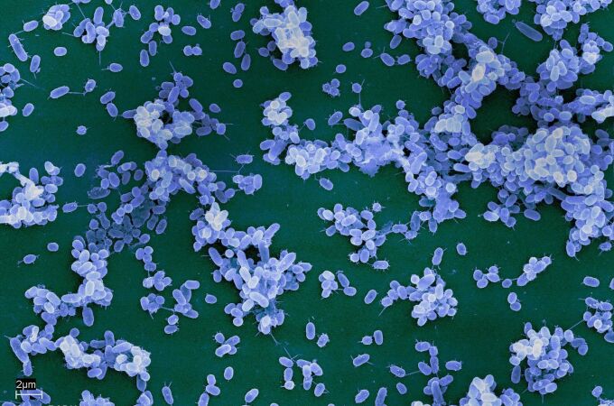 Imagen de bacterias en una superficie de vidrio