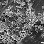 Imagen captada por microscopía electrónica de barrido donde se ve las nanoflores de óxido de hierro sobre microplásticos