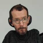 Echenique comparece mañana en el juzgado por presunto delito de odio contra sacerdotes en un tuit