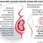 Alteraciones del corazón antes de nacer