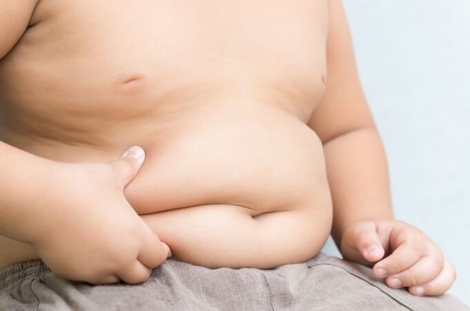 Niño con obesidad
