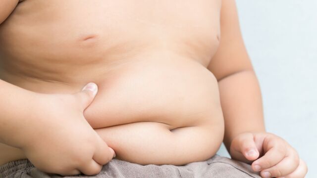 Niño con obesidad
