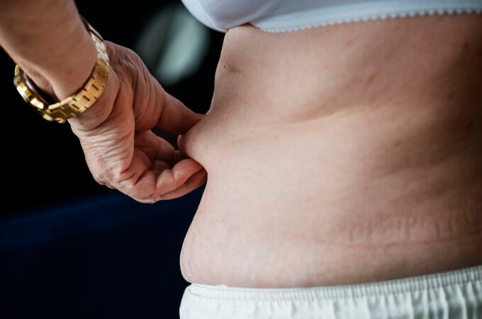 Revolución antiobesidad: logran convertir los dañinos ácidos grasos del cuerpo en omega 3