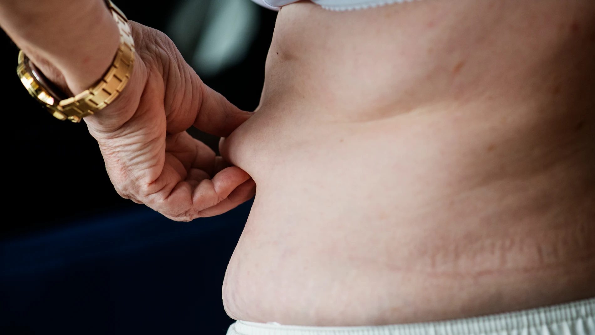 Revolución antiobesidad: logran convertir los dañinos ácidos grasos del cuerpo en omega 3
