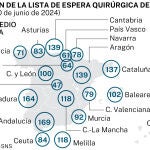 Esperas quirúrgicas en las ccaa