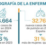 Radiografía del cáncer de pulmón