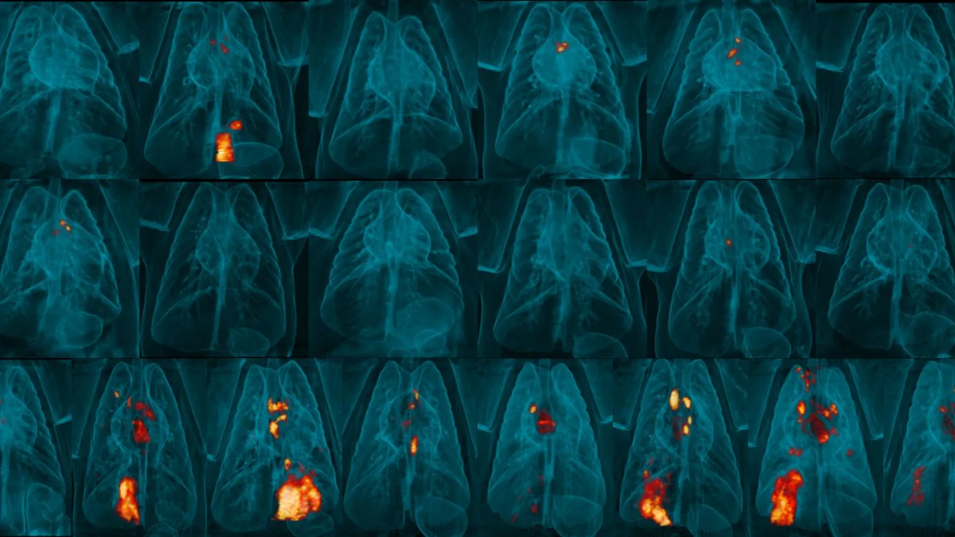 Si bien los monos macacos no vacunados exhibieron signos de inflamación y enfermedad pulmonar severa tras la infección por Mycobacterium tuberculosis (los colores cálidos indican inflamación y enfermedad, fila inferior), los monos que recibieron la vacuna BCG Kill-Switch administrada por vía intravenosa (fila del medio) estuvieron igualmente o mejor protegidos contra la infección que aquellos inmunizados con la vacuna BCG estándar (fila superior)