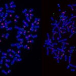 Cromosomas de células cancerosas con ADN teñido de azul, telómeros teñidos de verde y centrómeros teñidos de rosa