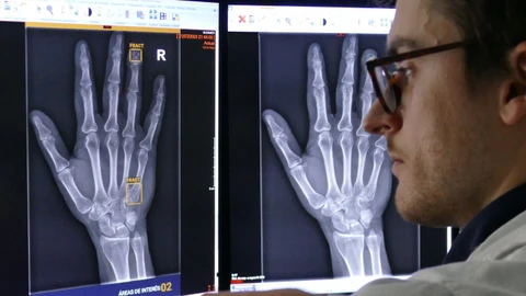 La Inteligencia Artificial realiza un diagnóstico casi inmediato y no se cansa