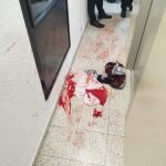 La ropa ensangrentada de la víctima del apuñalamiento socorrido por la Policía