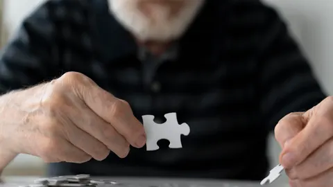 La pérdida de memoria reciente es una de las características de la enfermedad de Alzheimer