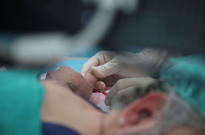 La articulación que une dedo pulgar con muñeca puede desgastarse de forma precoz por sobreúso