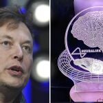 Así es "Telepathy": el chip que Elon Musk planea implantar a 30 personas en 2025 tras su primer éxito en humanos