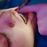 Ortodoncista revisando los brackets