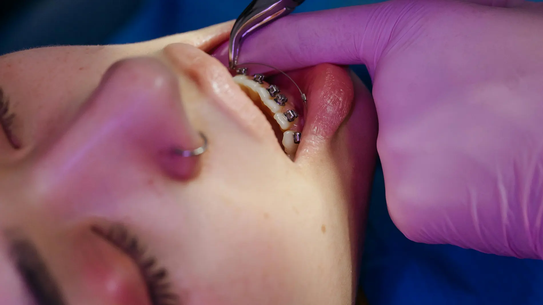 Ortodoncista revisando los brackets