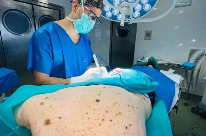 Intervención quirúrgica en el Hospital Virgen Macarena de Sevilla de un melanoma