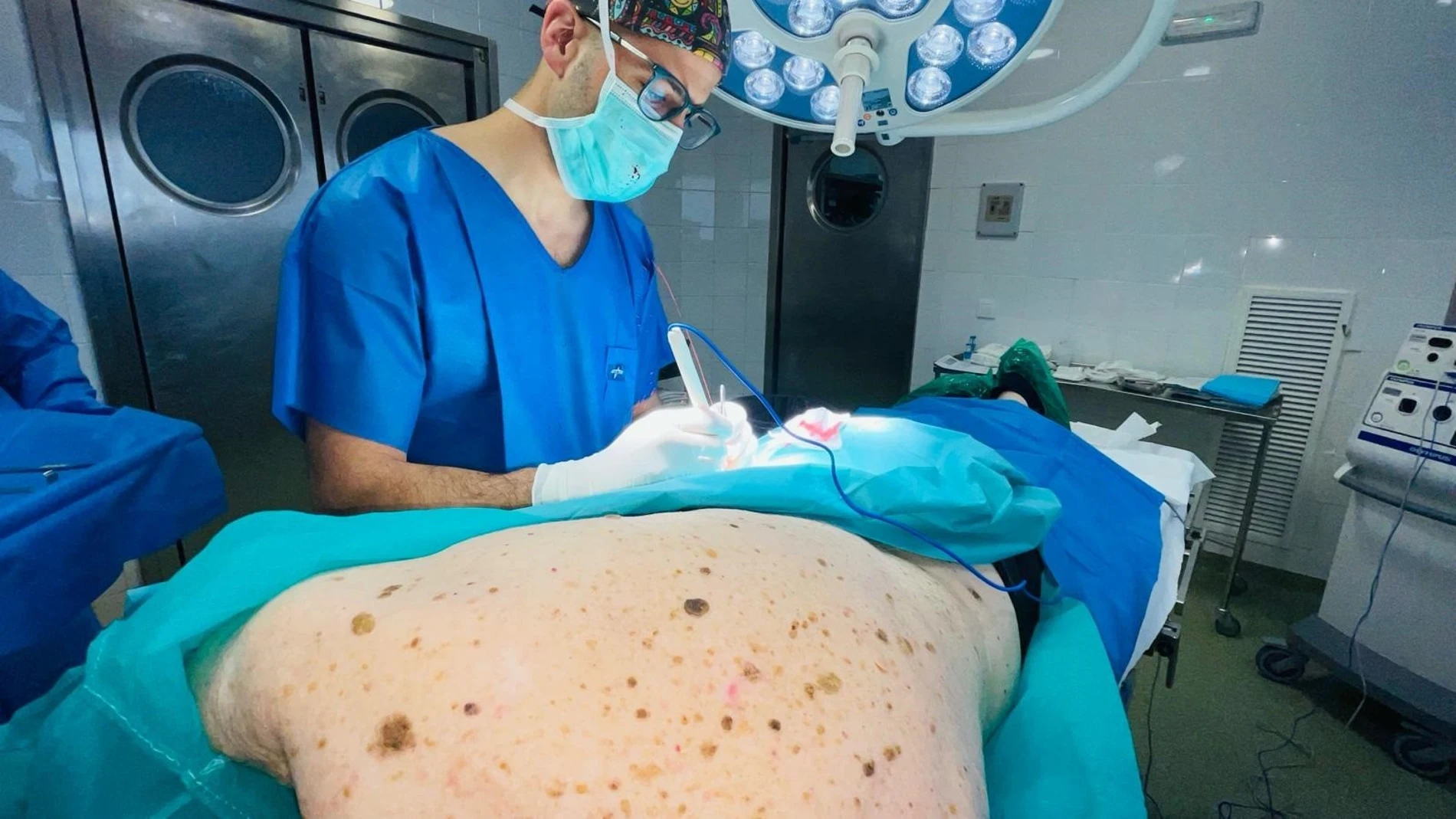 Intervención quirúrgica en el Hospital Virgen Macarena de Sevilla de un melanoma REMITIDA / HANDOUT por HOSPITAL VIRGEN MACARENA DE SEVILLA Fotografía remitida a medios de comunicación exclusivamente para ilustrar la noticia a la que hace referencia la imagen, y citando la procedencia de la imagen en la firma 23/05/2025