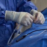 Un millón de personas sufre esta arritmia en España