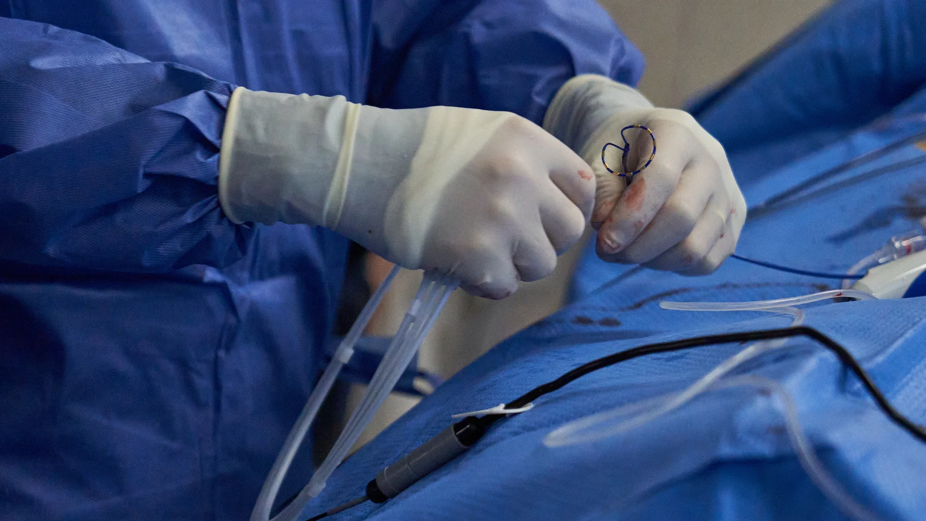 Un millón de personas sufre esta arritmia en España