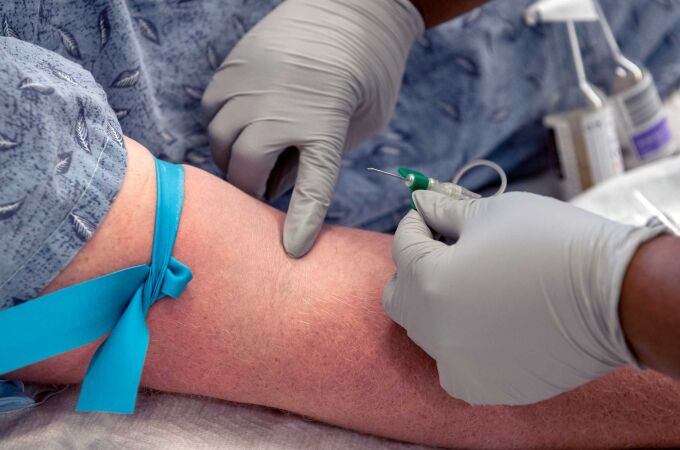 La sepsis causa cerca de 20.000 muertes anuales en España; los hemocultivos son esenciales para su detección temprana y tratamiento eficaz.