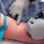 La sepsis causa cerca de 20.000 muertes anuales en España; los hemocultivos son esenciales para su detección temprana y tratamiento eficaz.