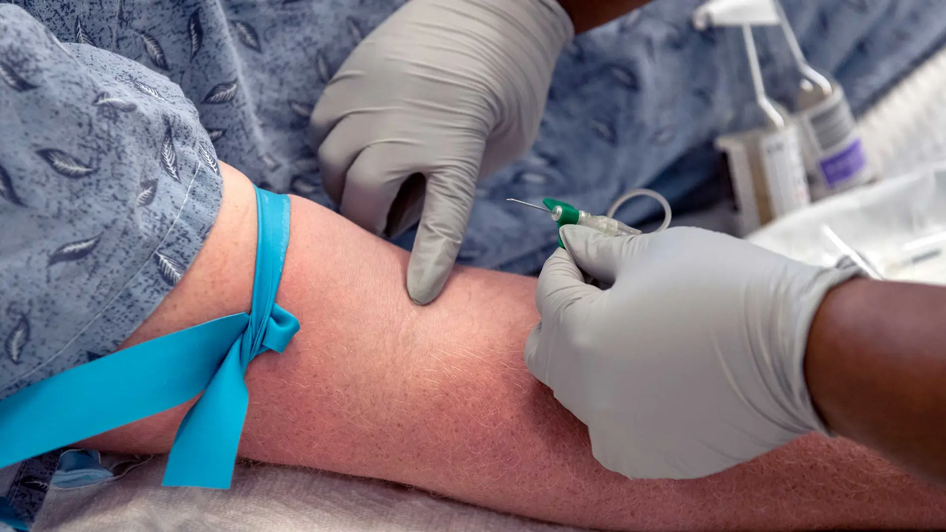 La sepsis causa cerca de 20.000 muertes anuales en España; los hemocultivos son esenciales para su detección temprana y tratamiento eficaz.