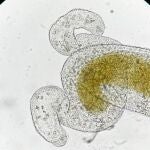 Grupos de esporas del parásito ‘Ordospora colligata’ vistos como puntos negros dentro del intestino del huésped ‘Daphnia magna’ 