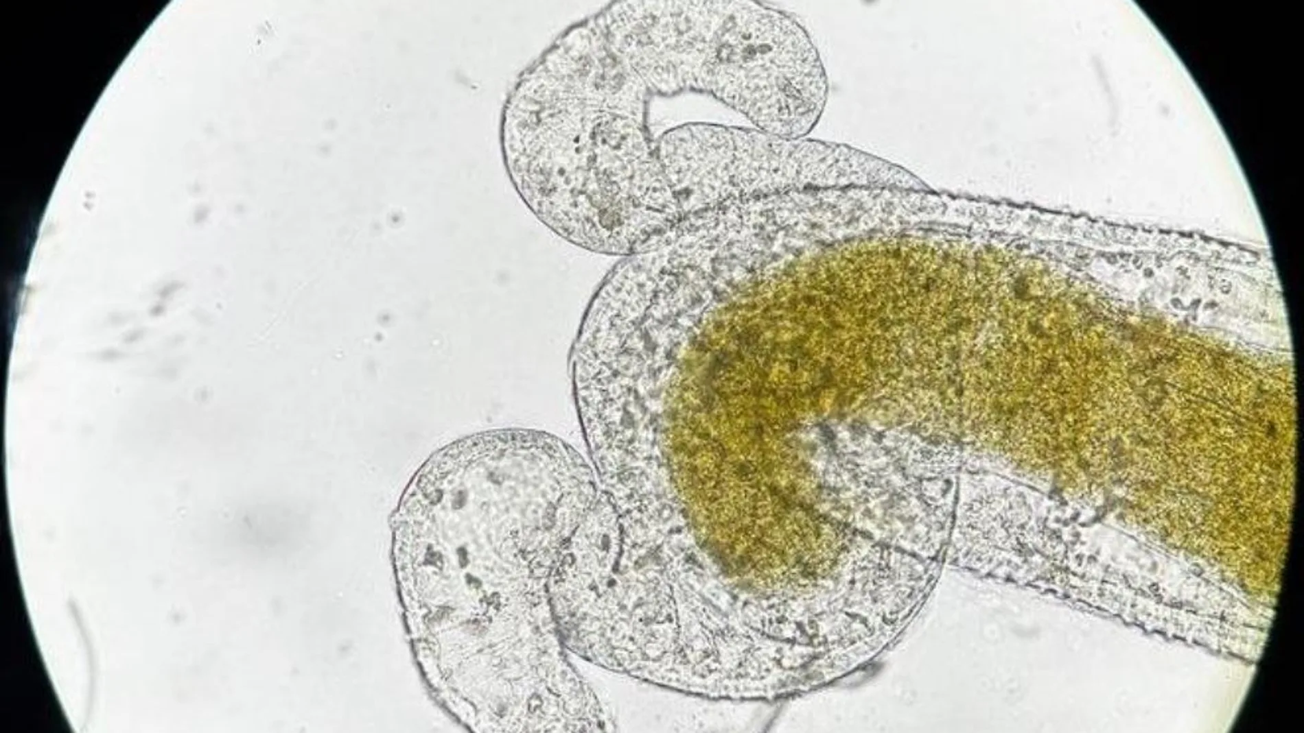 Grupos de esporas del parásito ‘Ordospora colligata’ vistos como puntos negros dentro del intestino del huésped ‘Daphnia magna’