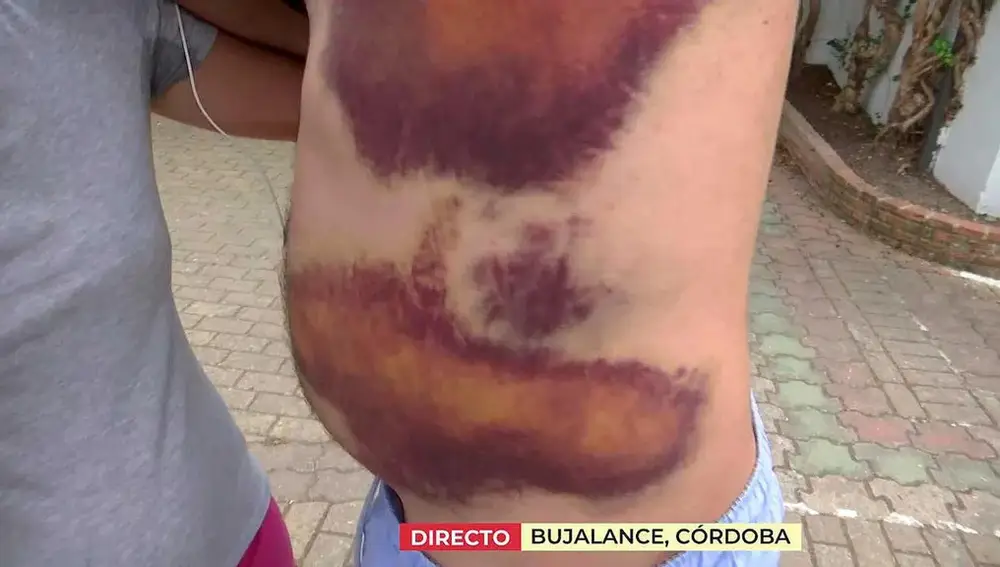El marido de Eloísa enseña las secuelas de la paliza