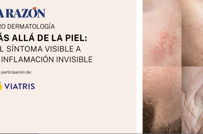Mesa redonda dermatología