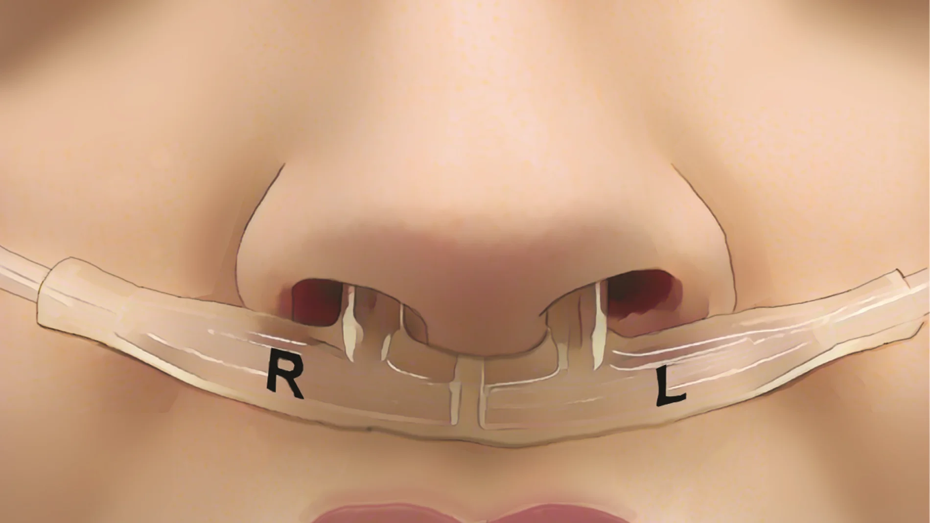 Tubos bajo la nariz midieron el flujo de aire de cada fosa nasal, revelando la huella respiratoria única de cada persona.