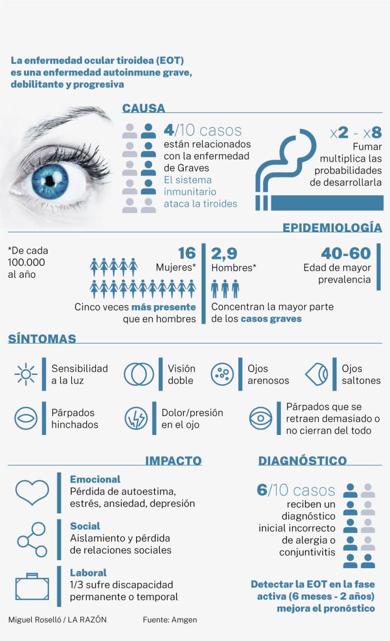 ¿Qué es la enfermedad ocular tiroidea?