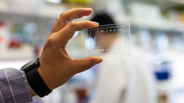 El nuevo dispositivo para detectar la infección de tuberculosis de la Universidad de Tulane tiene el tamaño de una tarjeta de crédito, no requiere electricidad y mejora significativamente la detección de la enfermedad en personas con VIH 
