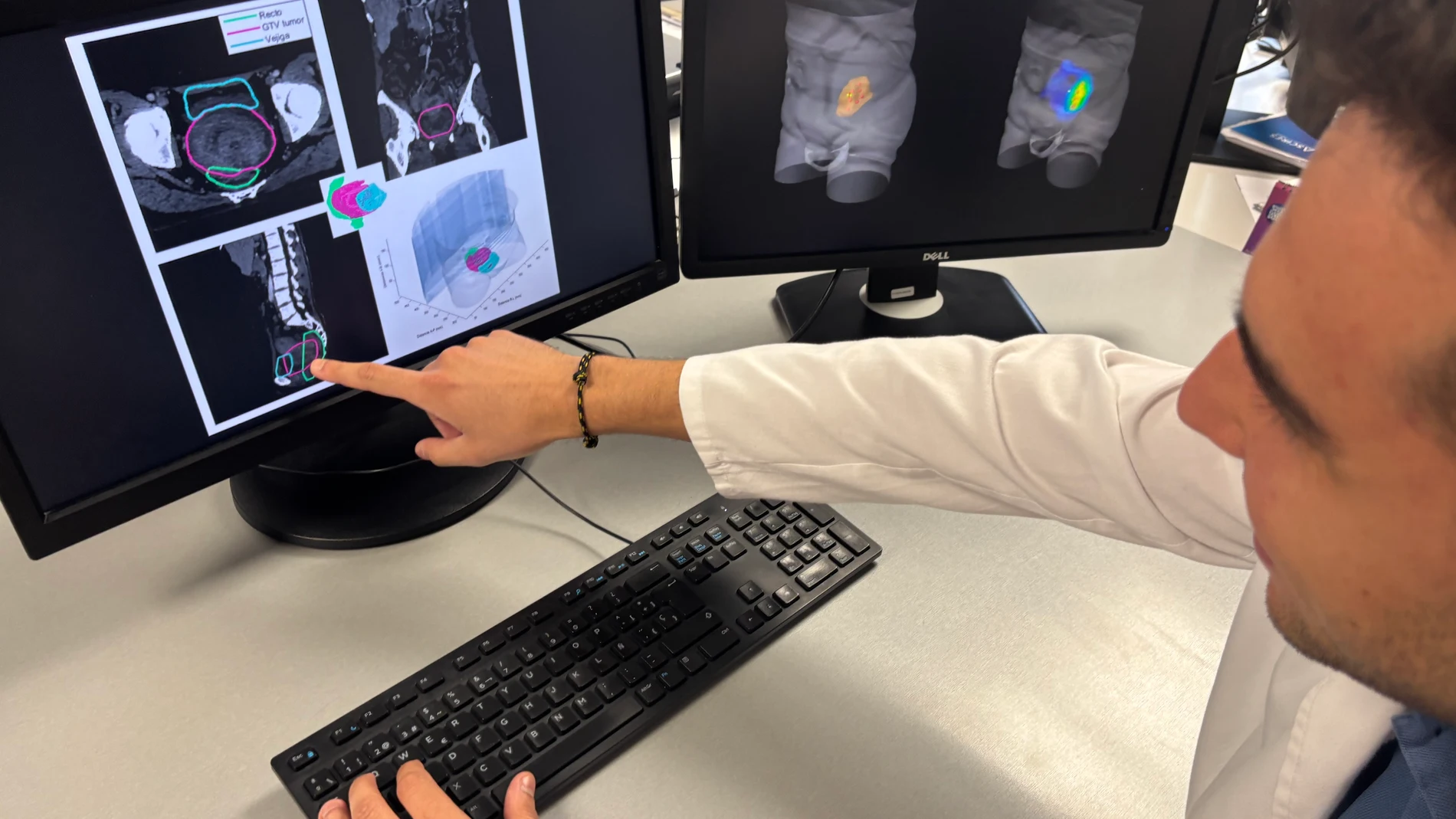 Ivace+i financia un proyecto para mejorar la precisión de los tratamientos de radioterapia que combaten el cáncer REMITIDA / HANDOUT por GVA Fotografía remitida a medios de comunicación exclusivamente para ilustrar la noticia a la que hace referencia la imagen, y citando la procedencia de la imagen en la firma 28/06/2025