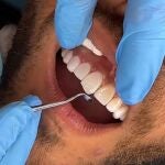 Un dentista realiza un tratamiento dental a un paciente