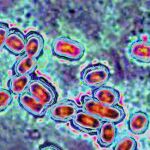 Microrobots combaten infecciones inusuales