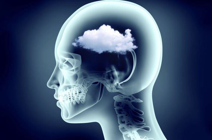 Migrañas, ¿son más frecuentes en verano?